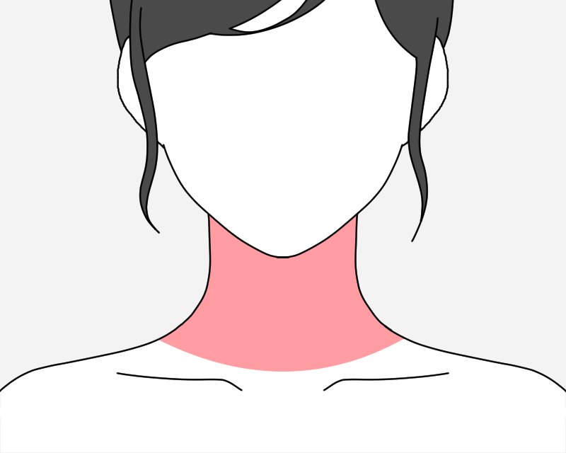 照射範囲イラスト