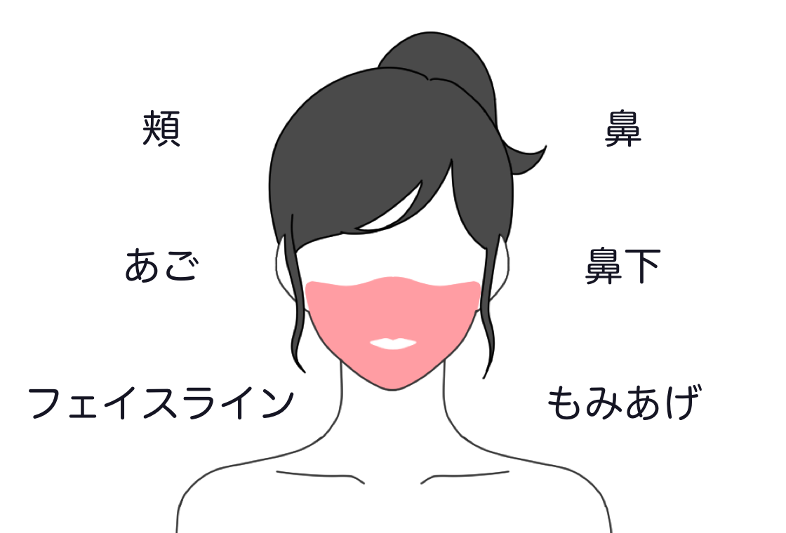 顔•女性プラン(頬、鼻、鼻下、あご、もみあげ、フェイスライン)
