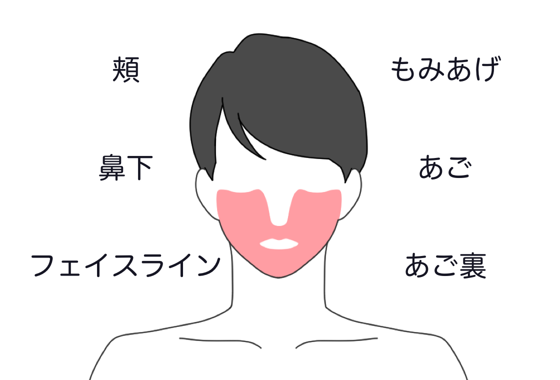 ヒゲ•男性プラン(頬、もみあげ、鼻下、あご、あご裏、フェイスライン)