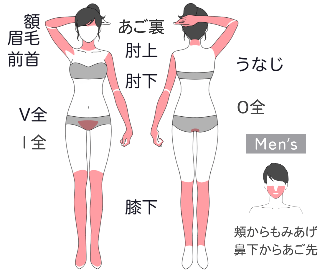 Mパーツ(額、眉毛、前首、肘上、肘下、うなじ、Vゾーン全体、Iライン、Oライン、膝下、)