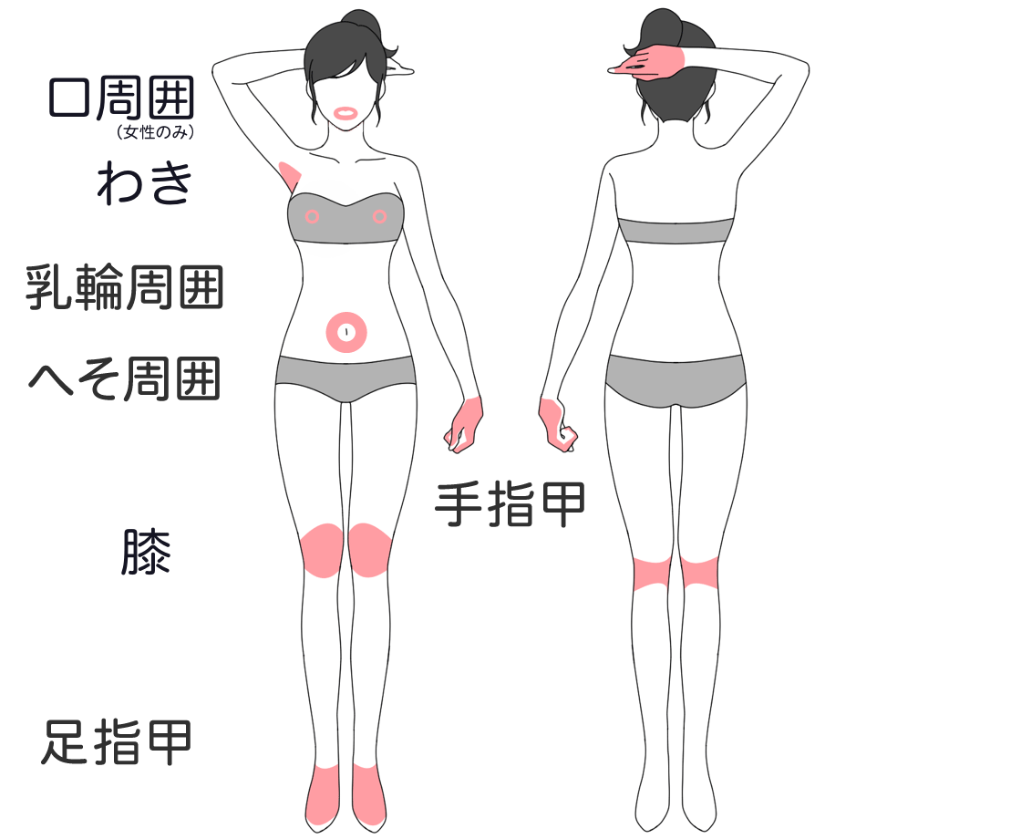 Sパーツ7部位(口周囲、あご裏、わき、膝、手指手の甲、膝、足指足の甲)